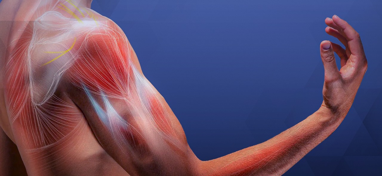 علاج اختناقات الأوتار بدون جراحة