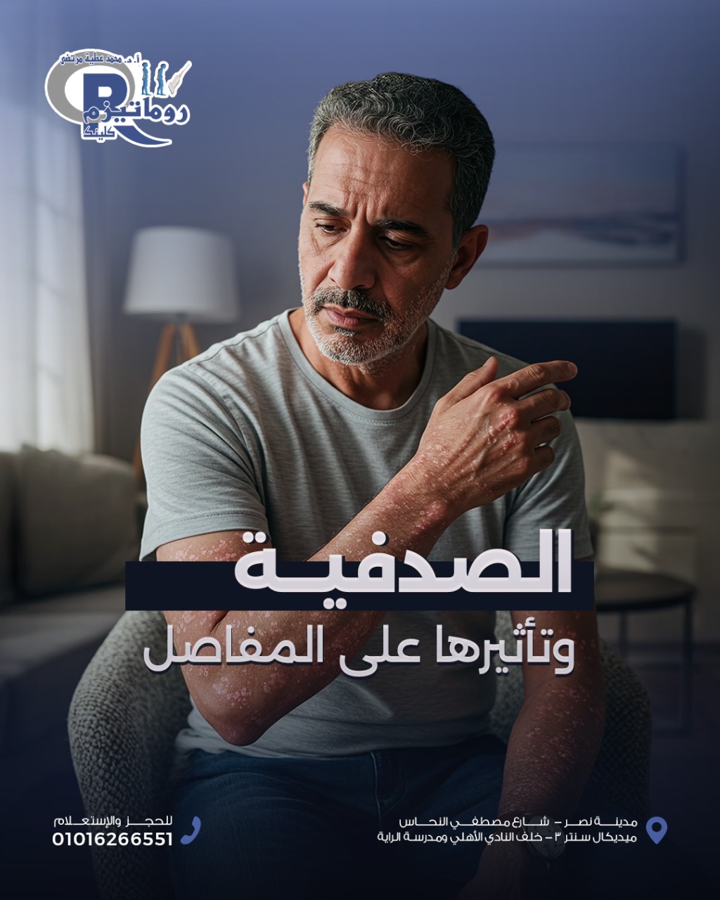  الصدفية ليست مرضًا جلديًا فقط… قد تصيب المفاصل والعمود الفقري أيضًا